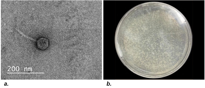 TEM images of two phages