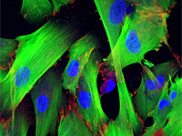 cytoskeleton