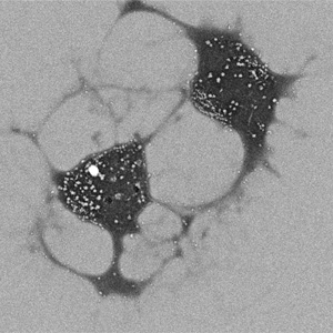 nanoparticle