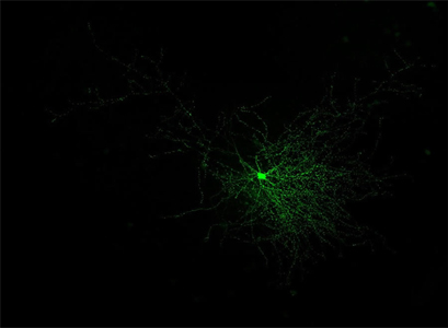 fast-spiking neuron