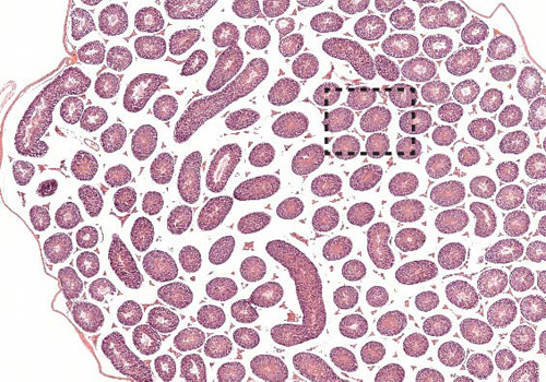 granulocyte