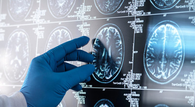 brain scans
