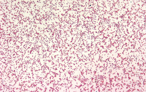 Francisella tularensis coccobacilli